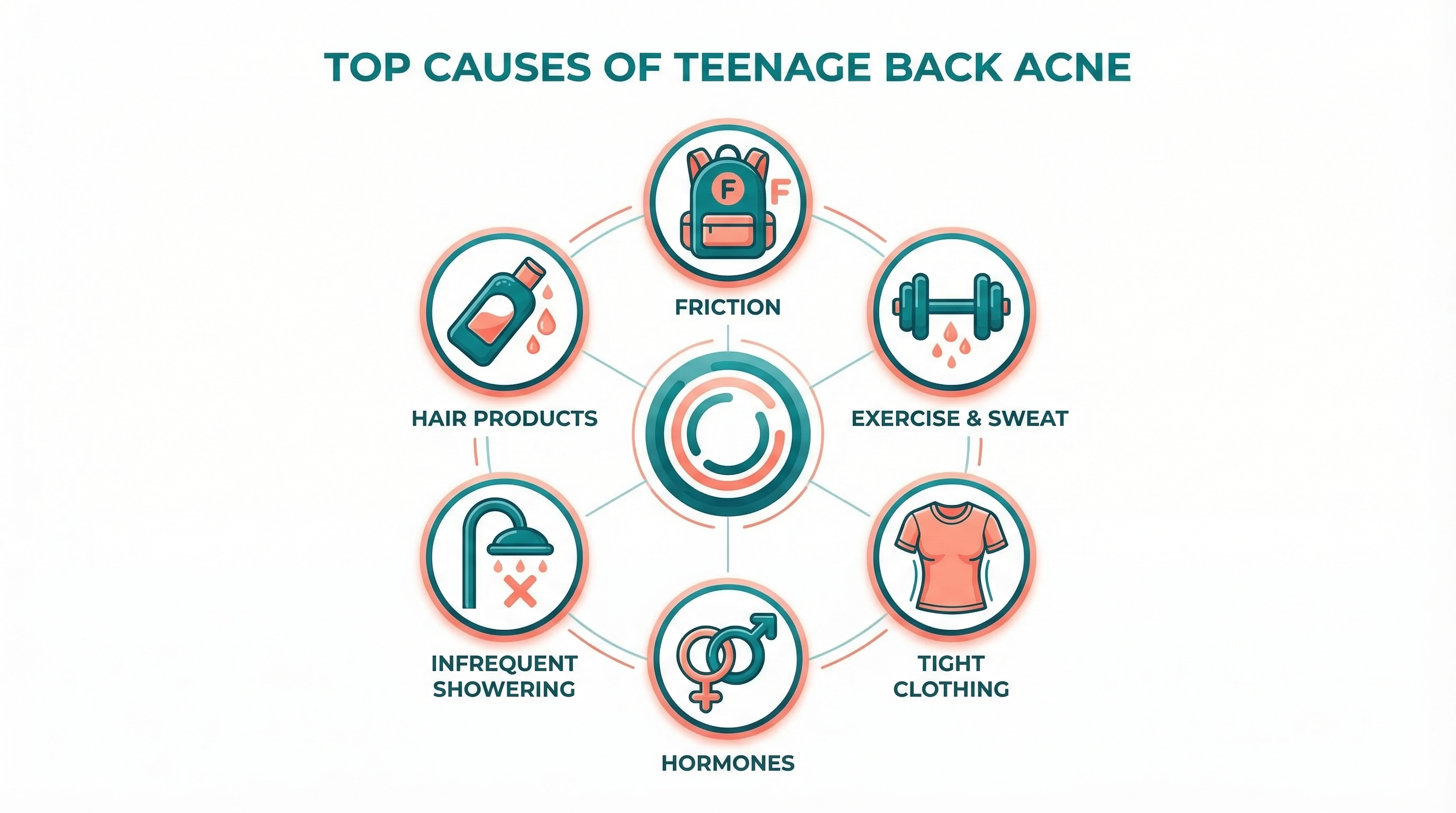 Photo showing helmet acne pattern on a teen's forehead, with breakouts matching the helmet padding contact points