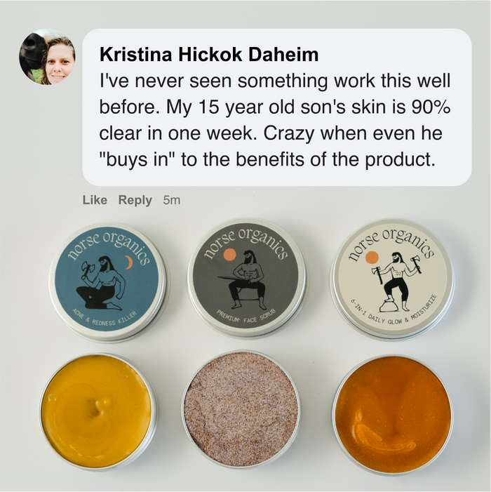 Norse Organics Kill Acne & Redness Ritual product lineup